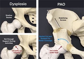 Minimally Invasive Techniques