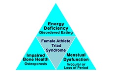 Female Athlete Triad Syndrome