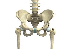 Periacetabular Osteotomy